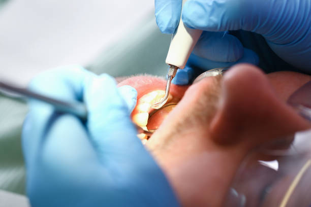 Best Broken or Chipped Tooth Repair in Greenwood, MO